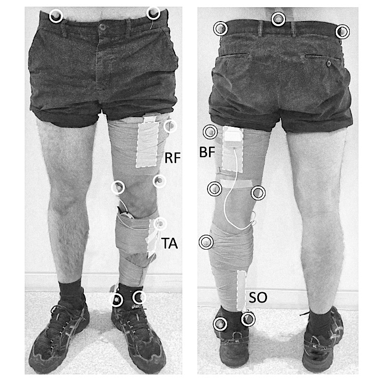 Black and white picture of high-density electromyography grid placements on a subject, and motion capture marker placements.